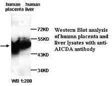 AICDA / AID Antibody