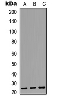 AICDA / AID Antibody - Western blot analysis of AID expression in MCF7 (A); NS-1 (B); PC12 (C) whole cell lysates.