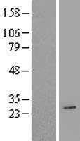 AICDA / AID Protein - Western validation with an anti-DDK antibody * L: Control HEK293 lysate R: Over-expression lysate