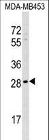 AIDA Antibody - AIDA Antibody western blot of MDA-MB453 cell line lysates (35 ug/lane). The AIDA antibody detected the AIDA protein (arrow).
