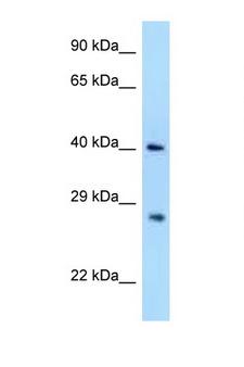 AIDA Antibody - AIDA antibody Western blot of 293T Cell lysate. Antibody concentration 1 ug/ml.  This image was taken for the unconjugated form of this product. Other forms have not been tested.