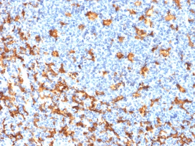 AIF1 / IBA1 Antibody - Formalin-fixed, paraffin-embedded Human Tonsil stained with AIF1 / Iba1 Mouse Recombinant Monoclonal Antibody (rAIF1/1909).