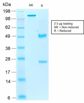 AIF1 / IBA1 Antibody - SDS-PAGE Analysis Purified AIF1 / Iba1 Mouse Recombinant Monoclonal Antibody (rAIF1/1909). Confirmation of Purity and Integrity of Antibody.