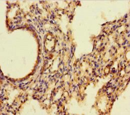 AIF1 / IBA1 Antibody - Immunohistochemistry of paraffin-embedded human lung tissue using AIF1 Antibody at dilution of 1:100