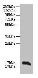 AIF1 / IBA1 Antibody - Western blot All lanes: Allograft inflammatory factor 1 antibody at 2µg/ml + THP-1 whole cell lysate Secondary Goat polyclonal to rabbit IgG at 1/10000 dilution Predicted band size: 17 kDa Observed band size: 17 kDa