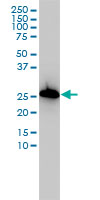 AIF1 / IBA1 Antibody - AIF1 monoclonal antibody (M01), clone 2A2-B6 Western Blot analysis of AIF1 expression in K-562.