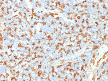 AIF1 / IBA1 Antibody - IHC testing of FFPE human lymph node with IBA1 antibody (clone AIF1/1909). HIER: boil tissue sections in pH6, 10mM citrate buffer, for 10-20 min followed by cooling at RT for 20 min.