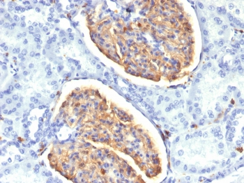 AIF1 / IBA1 Antibody - IHC testing of FFPE human kidney tissue with IBA1 antibody (clone AIF1/1909). HIER: boil tissue sections in pH6, 10mM citrate buffer, for 10-20 min followed by cooling at RT for 20 min.