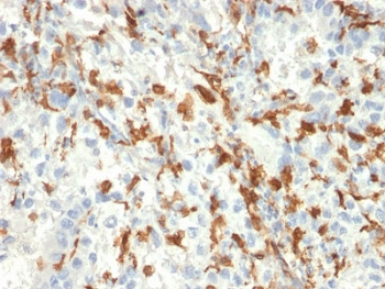 AIF1 / IBA1 Antibody - IHC testing of FFPE human kidney tissue with AIF1 antibody (clone AIF1/2493). HIER: boil tissue sections in pH6, 10mM citrate buffer, for 10-20 min followed by cooling at RT for 20 min.