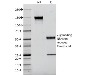 AIF1 / IBA1 Antibody - SDS-PAGE analysis of purified, BSA-free AIF1 antibody (clone AIF1/2493) as confirmation of integrity and purity.