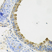 AIF1 / IBA1 Antibody - Immunohistochemistry of paraffin-embedded mouse lung using AIF1 antibodyat dilution of 1:100 (40x lens).