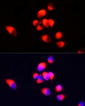 AIF1 / IBA1 Antibody - Immunofluorescence analysis of A431 cells using AIF1 antibodyat dilution of 1:100 (40x lens). Blue: DAPI for nuclear staining.
