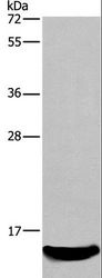 AIF1 / IBA1 Antibody - Western blot analysis of Mouse kidney tissue, using AIF1 Polyclonal Antibody at dilution of 1:500.