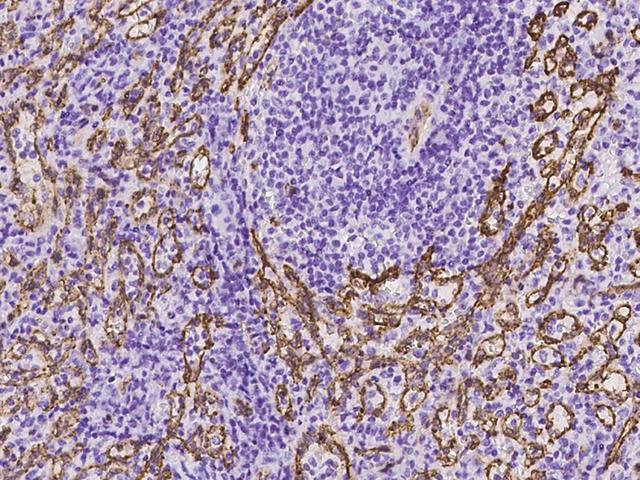 AIF1L Antibody - Immunochemical staining of human AIF1L in human spleen with rabbit polyclonal antibody at 1:500 dilution, formalin-fixed paraffin embedded sections.