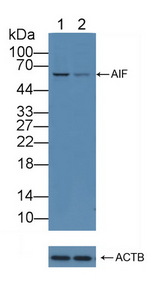 AIFM1 / AIF / PDCD8 Antibody - Knockout Varification: Lane 1: Wild-type A549 cell lysate; Lane 2: AIF knockout A549 cell lysate; Predicted MW: 26~35,66kd Observed MW: 66kd Primary Ab: 3µg/ml Rabbit Anti-Human AIF Antibody Second Ab: 0.2µg/mL HRP-Linked Caprine Anti-Rabbit IgG Polyclonal Antibody
