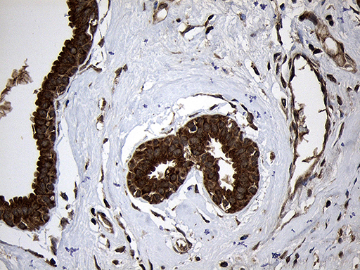 AIFM1 / AIF / PDCD8 Antibody - Immunohistochemical staining of paraffin-embedded Human breast tissue within the normal limits using anti-AIFM1 mouse monoclonal antibody. (Heat-induced epitope retrieval by 1mM EDTA in 10mM Tris buffer. (pH8.5) at 120°C for 3 min. (1:500)