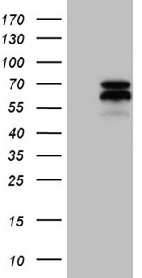 AIFM1 / AIF / PDCD8 Antibody - HEK293T cells were transfected with the pCMV6-ENTRY control. (Left lane) or pCMV6-ENTRY AIFM1. (Right lane) cDNA for 48 hrs and lysed. Equivalent amounts of cell lysates. (5 ug per lane) were separated by SDS-PAGE and immunoblotted with anti-AIFM1. (1:2000)