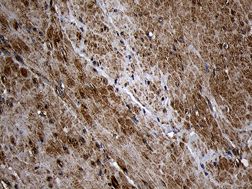 AIFM1 / AIF / PDCD8 Antibody - Immunohistochemical staining of paraffin-embedded Human bladder tissue within the normal limits using anti-AIFM1 mouse monoclonal antibody. (Heat-induced epitope retrieval by 1mM EDTA in 10mM Tris buffer. (pH8.5) at 120°C for 3 min. (1:500)