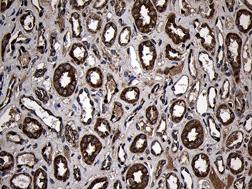 AIFM1 / AIF / PDCD8 Antibody - Immunohistochemical staining of paraffin-embedded Human Kidney tissue within the normal limits using anti-AIFM1 mouse monoclonal antibody. (Heat-induced epitope retrieval by 1mM EDTA in 10mM Tris buffer. (pH8.5) at 120°C for 3 min. (1:500)
