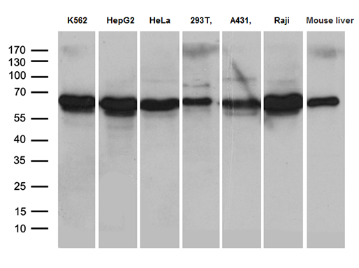 AIFM1 / AIF / PDCD8 Antibody - Western blot analysis of extracts. (35ug) from 6 different cell lines and mouse brain tissue lysate by using anti-AIFM1 monoclonal antibody. (1:500)