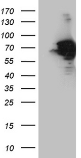 AIFM1 / AIF / PDCD8 Antibody - HEK293T cells were transfected with the pCMV6-ENTRY control. (Left lane) or pCMV6-ENTRY AIFM1. (Right lane) cDNA for 48 hrs and lysed. Equivalent amounts of cell lysates. (5 ug per lane) were separated by SDS-PAGE and immunoblotted with anti-AIFM1. (1:2000)