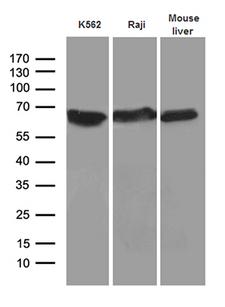 AIFM1 / AIF / PDCD8 Antibody - Western blot analysis of extracts. (35ug) from 2 different cell lines and mouse liver tissue lysate by using anti-AIFM1 monoclonal antibody. (1:500)