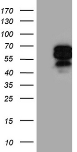 AIFM1 / AIF / PDCD8 Antibody - HEK293T cells were transfected with the pCMV6-ENTRY control. (Left lane) or pCMV6-ENTRY AIFM1. (Right lane) cDNA for 48 hrs and lysed. Equivalent amounts of cell lysates. (5 ug per lane) were separated by SDS-PAGE and immunoblotted with anti-AIFM1. (1:2000)