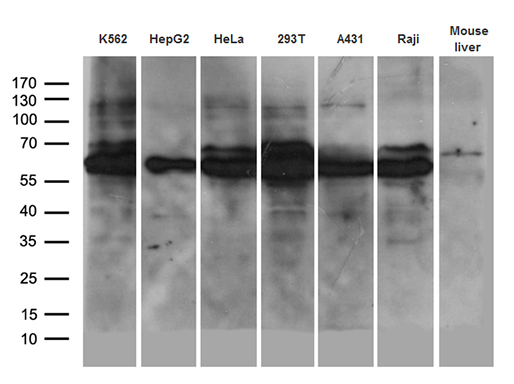 AIFM1 / AIF / PDCD8 Antibody - Western blot analysis of extracts. (35ug) from 6 different cell lines and mouse liver tissue lysate by using anti-AIFM1 monoclonal antibody. (1:500)