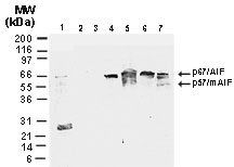 AIFM1 / AIF / PDCD8 Antibody - Western blot of AIF in human colon using AIFM1 / AIF / PDCD8 Antibody at 1:2000. Lane 1, normal colon. Lanes 2-7, colon carcinoma tissue lysates from 6 different patients. mAIF, thought to represent mitochondrial AIF.