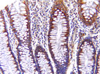 AIFM1 / AIF / PDCD8 Antibody - IHC of AIF in formalin-fixed, paraffin-embedded normal human colon using AIFM1 / AIF / PDCD8 Antibody at 1:2000. Hematoxylin-Eosin counterstain. In this example, AIF expression is predominant in the upper part of the crypt.