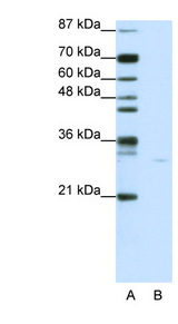 AIFM1 / AIF / PDCD8 Antibody - AIFM1 / AIF antibody Western blot of Jurkat lysate. This image was taken for the unconjugated form of this product. Other forms have not been tested.