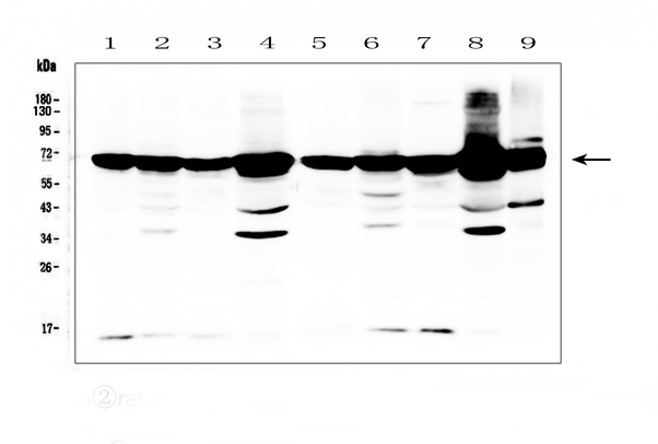AIFM1 / AIF / PDCD8 Antibody - Western blot analysis of AIF using anti-AIF antibody. Electrophoresis was performed on a 5-20% SDS-PAGE gel at 70V (Stacking gel) / 90V (Resolving gel) for 2-3 hours. The sample well of each lane was loaded with 50ug of sample under reducing conditions. Lane 1: rat spleen tissue lysates, Lane 2: rat ovary tissue lysates, Lane 3: rat lung tissue lysates, Lane 4: rat liver tissue lysates, Lane 5: mouse spleen tissue lysates, Lane 6: mouse testis tissue lysates, Lane 7: mouse lung tissue lysates, Lane 8: mouse liver tissue lysates, Lane 9: mouse ovary tissue lysates. After Electrophoresis, proteins were transferred to a Nitrocellulose membrane at 150mA for 50-90 minutes. Blocked the membrane with 5% Non-fat Milk/ TBS for 1.5 hour at RT. The membrane was incubated with rabbit anti-AIF antigen affinity purified polyclonal antibody at 0.5 µg/mL overnight at 4°C, then washed with TBS-0.1% Tween 3 times with 5 minutes each and probed with a goat anti-rabbit IgG-HRP secondary antibody at a dilution of 1:10000 for 1.5 hour at RT. The signal is developed using an Enhanced Chemiluminescent detection (ECL) kit with Tanon 5200 system. A specific band was detected for AIF at approximately 67KD. The expected band size for AIF is at 67KD.