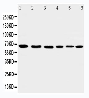 AIFM1 / AIF / PDCD8 Antibody - WB of AIFM1 / AIF antibody. Lane 1: Rat Heart Tissue Lysate. Lane 2: Rat Brain Tissue Lysate. Lane 3: K562 Cell Lysate. Lane 4: HEPG2 Cell Lysate. Lane 5: A431 Cell Lysate. Lane 6: NIH3T3 Cell Lysate.