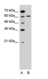 AIFM1 / AIF / PDCD8 Antibody - A: Marker, B: Jurkat Cell Lysate.  This image was taken for the unconjugated form of this product. Other forms have not been tested.