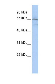 AIFM1 / AIF / PDCD8 Antibody - AIFM1 / AIF antibody Western blot of Jurkat Cell lysate. Antibody concentration 1 ug/ml. This image was taken for the unconjugated form of this product. Other forms have not been tested.