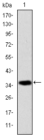 AIFM1 / AIF / PDCD8 Antibody - Western blot using AIF monoclonal antibody against human AIF (AA: 1-261) recombinant protein. (Expected MW is 35.6 kDa)