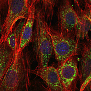 AIFM1 / AIF / PDCD8 Antibody - Immunofluorescence of NIH/3T3 cells using AIF mouse monoclonal antibody (green). Blue: DRAQ5 fluorescent DNA dye. Red: Actin filaments have been labeled with Alexa Fluor-555 phalloidin.