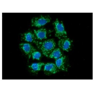 AIFM1 / AIF / PDCD8 Antibody - ICC/IF analysis of AIFM1 in Hep3B cells line, stained with DAPI (Blue) for nucleus staining and monoclonal anti-human AIFM1 antibody (1:100) with goat anti-mouse IgG-Alexa fluor 488 conjugate (Green).