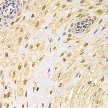 AIFM1 / AIF / PDCD8 Antibody - Immunohistochemistry of paraffin-embedded human esophageal tissue.