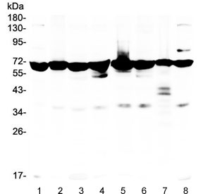 AIFM1 / AIF / PDCD8 Antibody - Western blot testing of 1) rat kidney, 2) rat brain, 3) mouse stomach, 4) mouse spleen, 5) human HeLa, 6) U87, 7) PANC lysate with AIF antibody. Expected molecular weight ~67 kDa, observed here at ~85 kDa.
