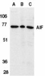 AIFM1 / AIF / PDCD8 Antibody - Western blot analysis of AIF in K562 cell lysate (A), rat heart (B), and mouse heart (C) tissue lysates with AIF (IN) antibody at 1µg/ml.