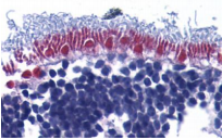 AIFM1 / AIF / PDCD8 Antibody - Immunohistochemistry of AIF in human retina with AIF (IN) antibody at 10µg/ml.