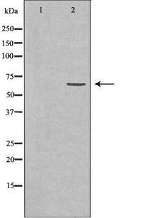 AIFM1 / AIF / PDCD8 Antibody - Western blot analysis of K562 whole cells lysates using AIFM1 antibody. The lane on the left is treated with the antigen-specific peptide.