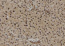 AIFM1 / AIF / PDCD8 Antibody - 1:100 staining mouse liver tissue by IHC-P. The sample was formaldehyde fixed and a heat mediated antigen retrieval step in citrate buffer was performed. The sample was then blocked and incubated with the antibody for 1.5 hours at 22°C. An HRP conjugated goat anti-rabbit antibody was used as the secondary.