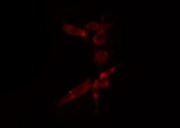 AIFM1 / AIF / PDCD8 Antibody - Staining HuvEc cells by IF/ICC. The samples were fixed with PFA and permeabilized in 0.1% Triton X-100, then blocked in 10% serum for 45 min at 25°C. The primary antibody was diluted at 1:200 and incubated with the sample for 1 hour at 37°C. An Alexa Fluor 594 conjugated goat anti-rabbit IgG (H+L) antibody, diluted at 1/600, was used as secondary antibody.