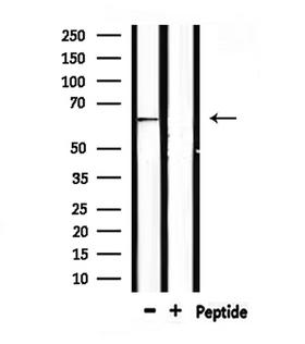 AIFM1 / AIF / PDCD8 Antibody - Western blot analysis of extracts of HepG2 cells using AIFM1 antibody.