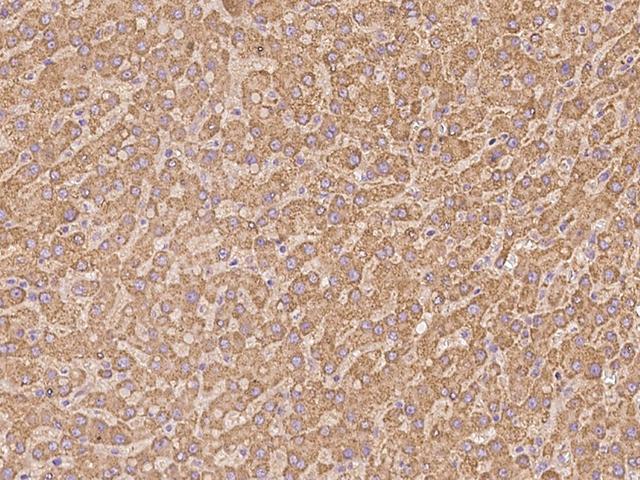 AIFM1 / AIF / PDCD8 Antibody - Immunochemical staining of human AIFM1 in human liver with rabbit polyclonal antibody at 1:100 dilution, formalin-fixed paraffin embedded sections.