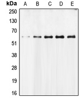AIFM1 / AIF / PDCD8 Antibody - Western blot analysis of AIFM1 expression in MCF7 (A); Molt (B); Jurkat (C); mouse liver (D); rat heart (E) whole cell lysates.