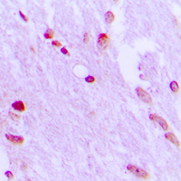 AIFM1 / AIF / PDCD8 Antibody - Immunohistochemical analysis of AIFM1 staining in human brain formalin fixed paraffin embedded tissue section. The section was pre-treated using heat mediated antigen retrieval with sodium citrate buffer (pH 6.0). The section was then incubated with the antibody at room temperature and detected using an HRP conjugated compact polymer system. DAB was used as the chromogen. The section was then counterstained with hematoxylin and mounted with DPX.