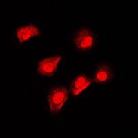 AIFM1 / AIF / PDCD8 Antibody - Immunofluorescent analysis of AIFM1 staining in MCF7 cells. Formalin-fixed cells were permeabilized with 0.1% Triton X-100 in TBS for 5-10 minutes and blocked with 3% BSA-PBS for 30 minutes at room temperature. Cells were probed with the primary antibody in 3% BSA-PBS and incubated overnight at 4 C in a humidified chamber. Cells were washed with PBST and incubated with a DyLight 594-conjugated secondary antibody (red) in PBS at room temperature in the dark. DAPI was used to stain the cell nuclei (blue).